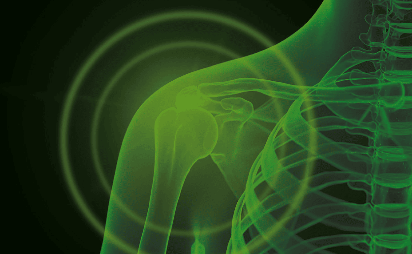 Digital illustration of a human upper torso and shoulder joint in green, with concentric circles highlighting the shoulder, suggesting focus on shoulder pain or injury.