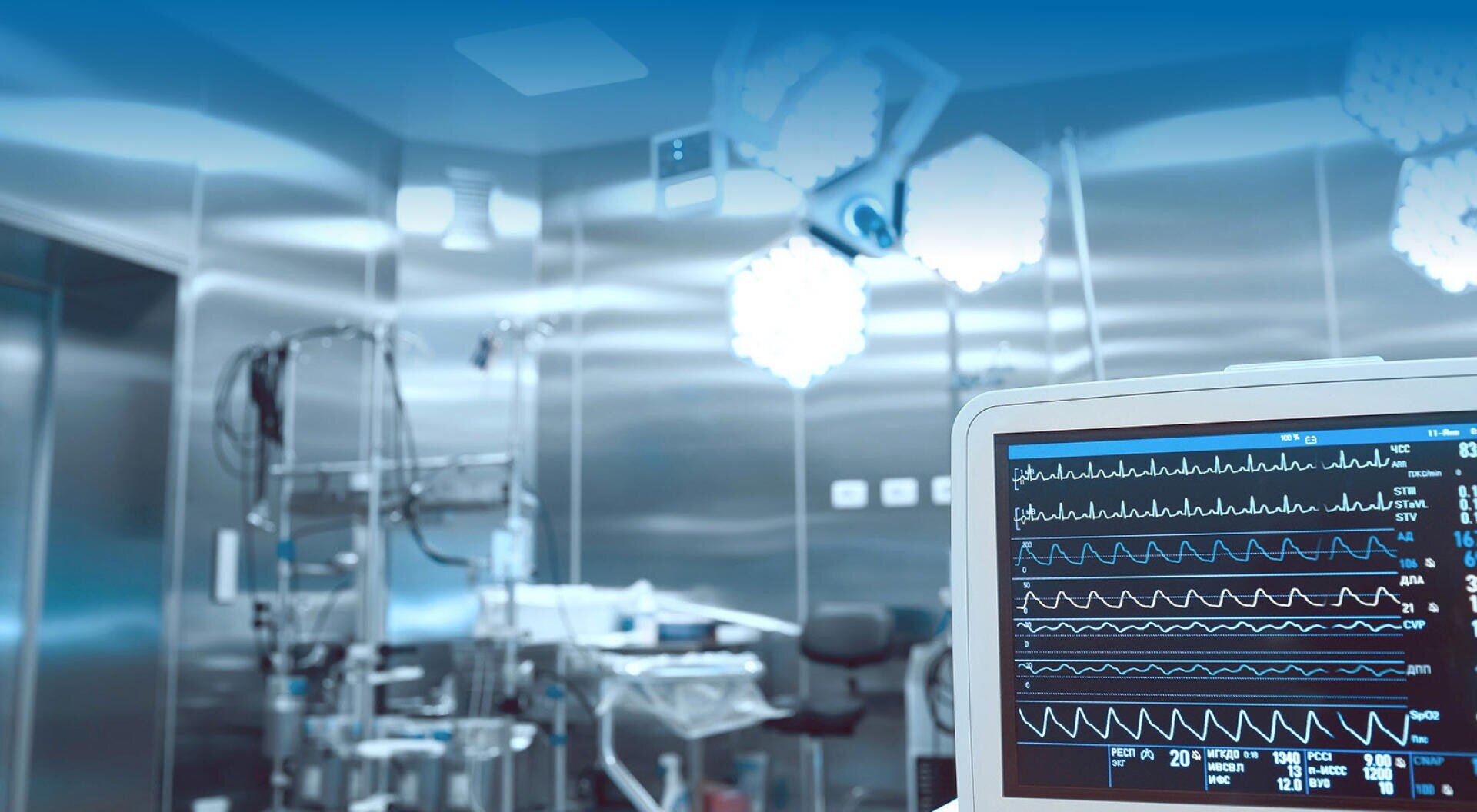 Ein moderner Krankenhaus-Operationssaal mit chirurgischen Geräten und hellem Licht, mit einer Nahaufnahme eines Monitors, der die Vitalwerte des Patienten anzeigt. Die Umgebung wirkt sauber und steril.