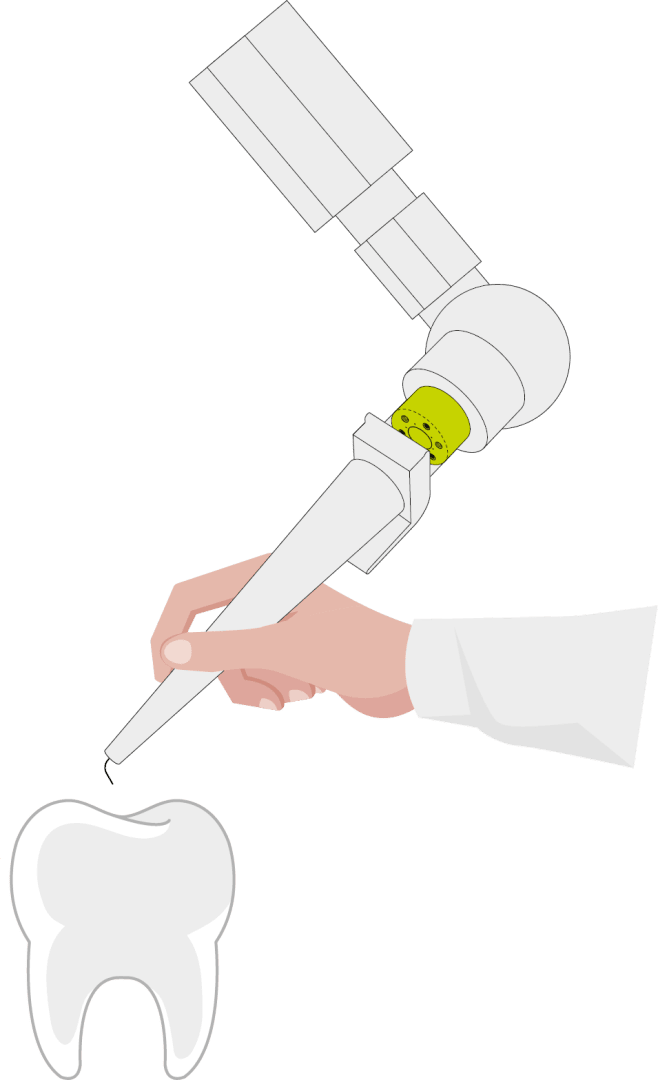 Eine Hand hält ein auf einen Zahn gerichtetes zahnärztliches Instrument, an dem ein großer mechanischer Arm befestigt ist, was auf eine robotergestützte Zahnbehandlung hindeutet.