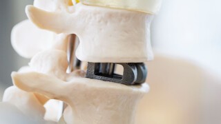 Implants and Prostheses/Orthoses